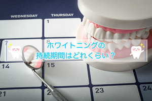 ホワイトニングの持続期間はどれくらい?長持ちさせるコツ