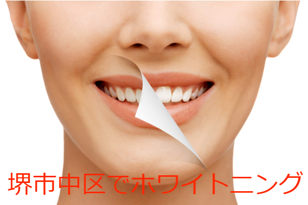 堺市中区でホワイトニングにおすすめの歯科クリニック5選