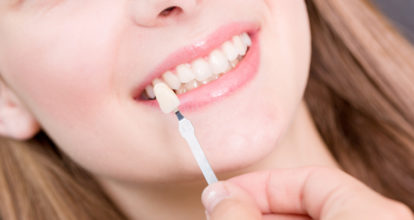 刈谷ホワイトニング