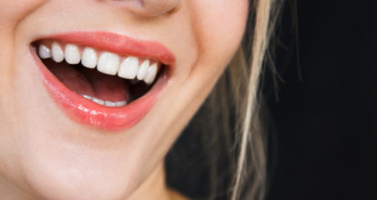 国分寺 ホワイトニング