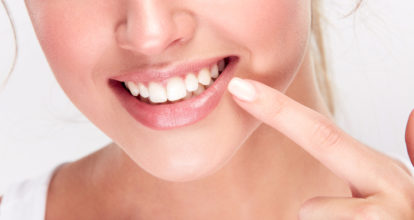 緑区　ホワイトニング