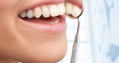 大垣市　ホワイトニング