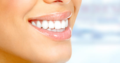 岡崎市　ホワイトニング