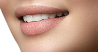 陸前高砂 ホワイトニング