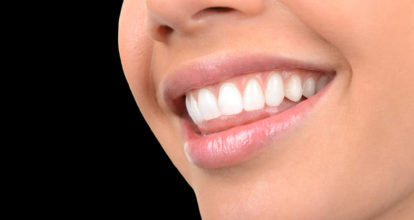 白金高輪 ホワイトニング