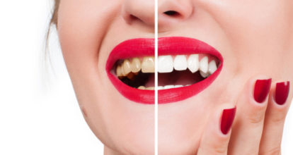 綺麗な歯の女性