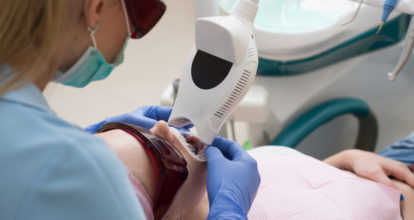 ホワイトニング治療