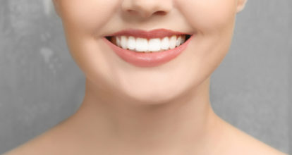 山科区 ホワイトニング