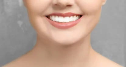 山科区 ホワイトニング