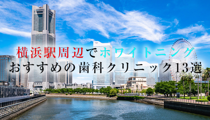 横浜でホワイトニングにおすすめの歯科クリニック13選！口コミと料金も掲載【2021年版】